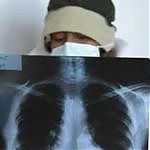 flu