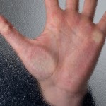 reasons  of diseases